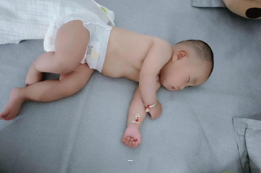 安溪宝宝脸上有白色斑块 安溪宝宝脸上有白色斑块